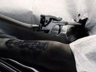 Scar