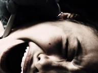 Scar