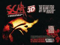 Scar