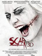 Scar