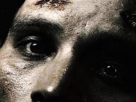 Scar