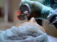 The Clonus Horror